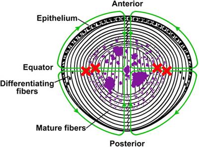 Connexin Mutants Cause Cataracts Through Deposition of Apatite